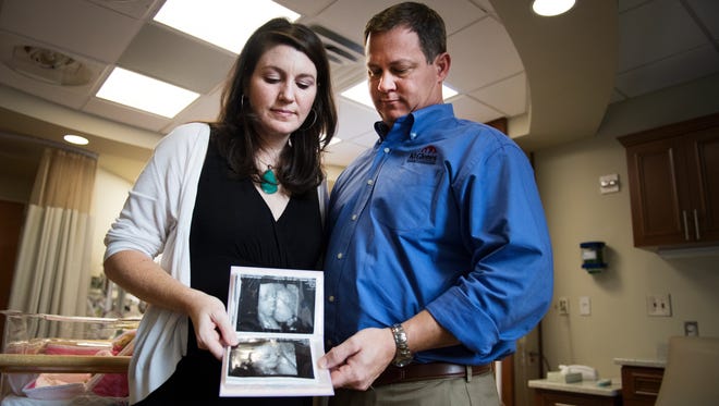 Natalie and Brent Watkins hold an ultrasound of their daughter, Hannah, who they lost at fullterm to stillbirth at Greenville Memorial Hospital on Monday, September 25, 2017. 