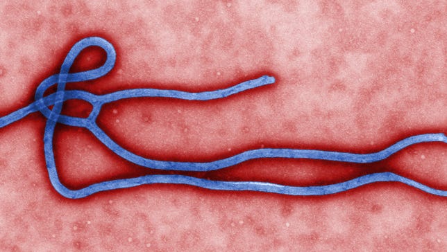 A colorized transmission of an electron micrograph (TEM) revealed some of the ultrastructural morphology displayed by an Ebola virus virion.