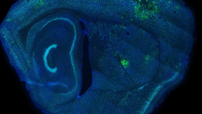 A mouse brain genetically engineered to show green where Toxoplasma Gondii has infected the brain.