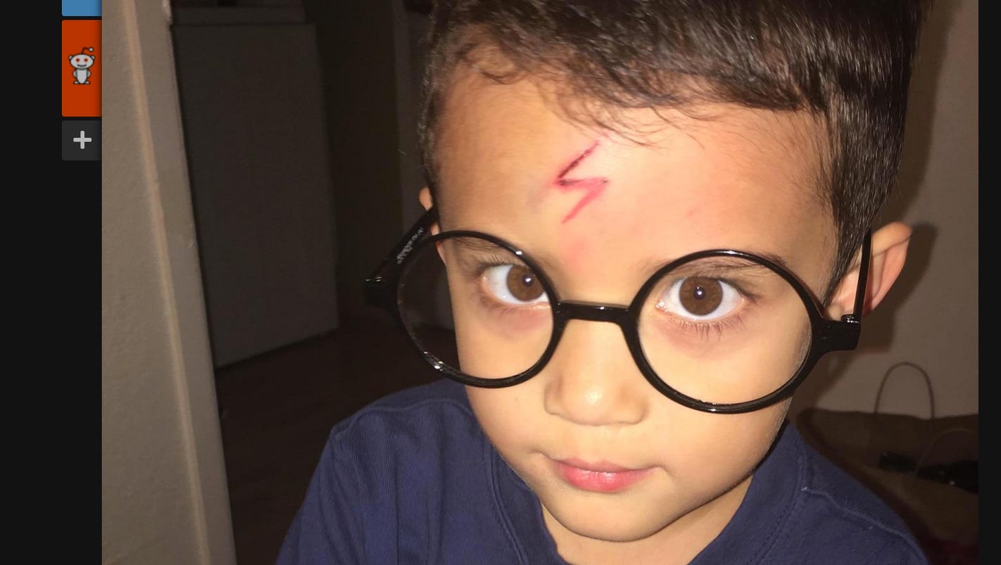 Mom turns boy's forehead cut into Harry Potter-themed scar