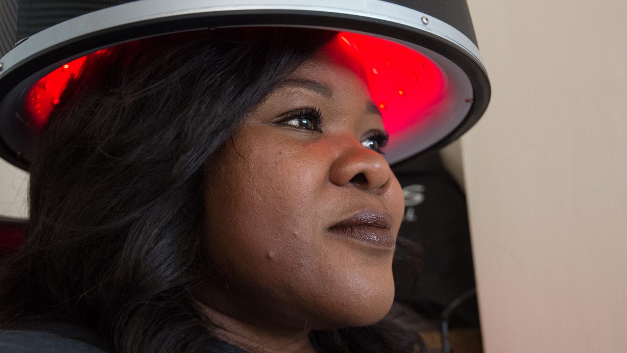 Womens Hair Loss Solution