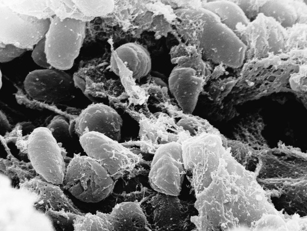 An image provided by Rocky Mountain Laboratories showing an electron micrograph depicting a mass of Yersinia pestis bacteria (the cause of bubonic plague).