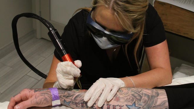 RN Codie Koenke removes a tattoo from tattoo artist Justin Ramos of Yucaipa at the Palm Trees and Tattoos convention at the Palm Springs Hard Rock Hotel.