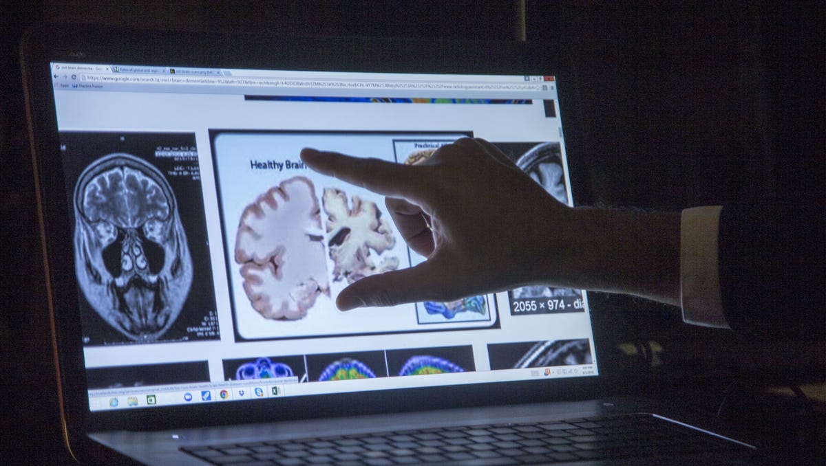 Dementia Facility Founder Educates Public On Proper Care Practices