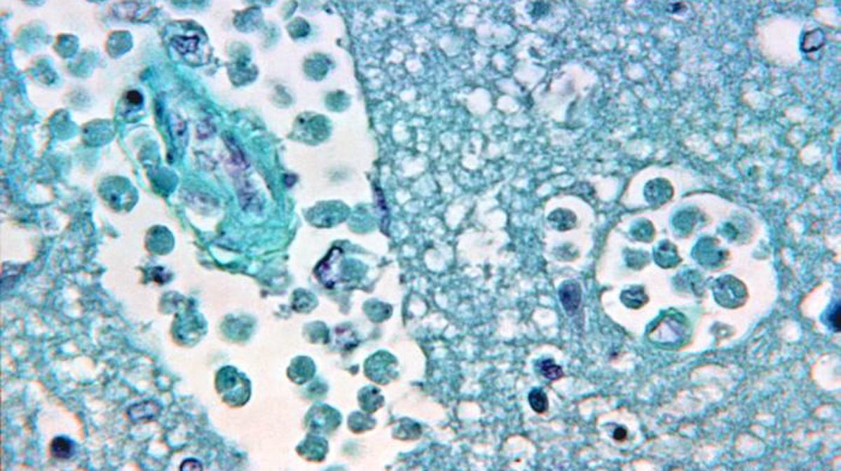 Officials Ease Warning On Deadly Brain Eating Microbe In Houston Water