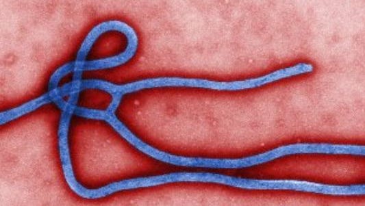This image made available by the Centers for Disease Control and Prevention shows the Ebola virus.