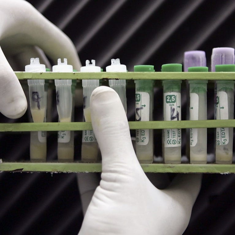 HIV/AIDS pandemic     • Disease:  HIV/AIDS     • Location:  Worldwide     • Duration:  1981-present     • Approx. number of deaths:  35 million First reported in California in 1981, AIDS is now one of the largest pandemics in the world. HIV, the virus that causes AIDS, jumped from chimpanzees to humans in early 20th century Africa, and spreads through contact with bodily fluids. Although AIDS has killed at least 35 million people   globally, current antiretroviral therapies can prevent its proliferation.