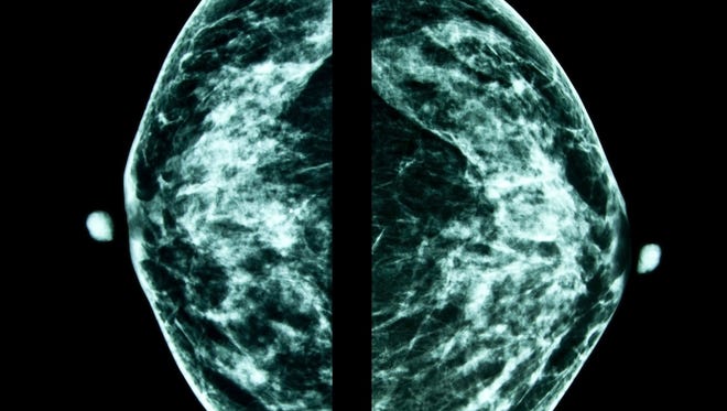 Dissertation On Mammograms✏️ : Buy cheap papers online