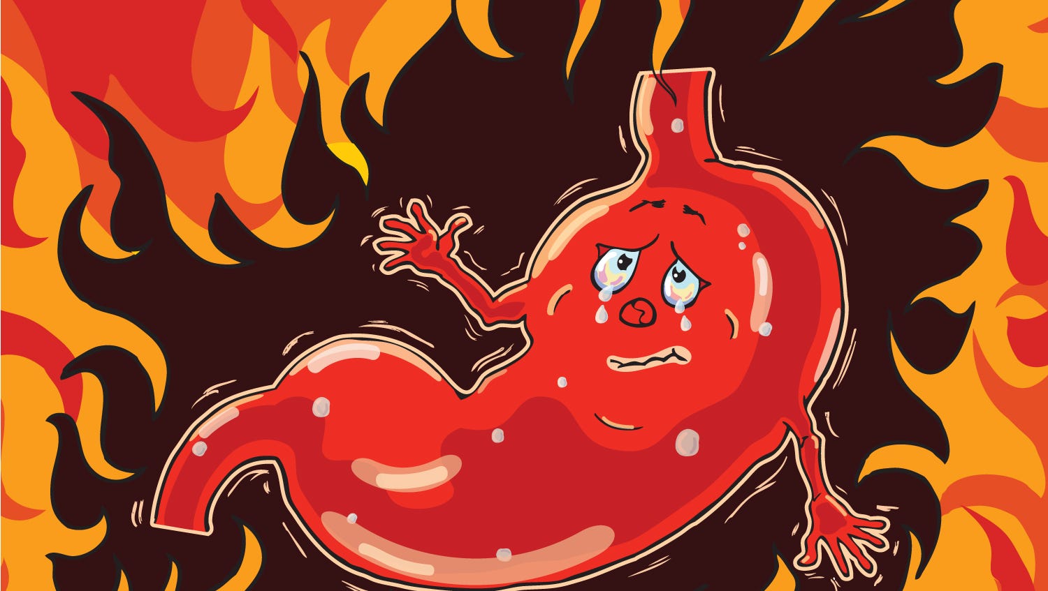 acid reflux or gerd serious heartburn
