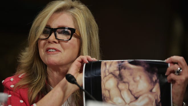 Rep. Marsha Blackburn, R-Tenn., holds up a sonogram picture of her unborn grandson as she testifies during a hearing before the Senate Judiciary Committee on July 15, 2014, in Washington.