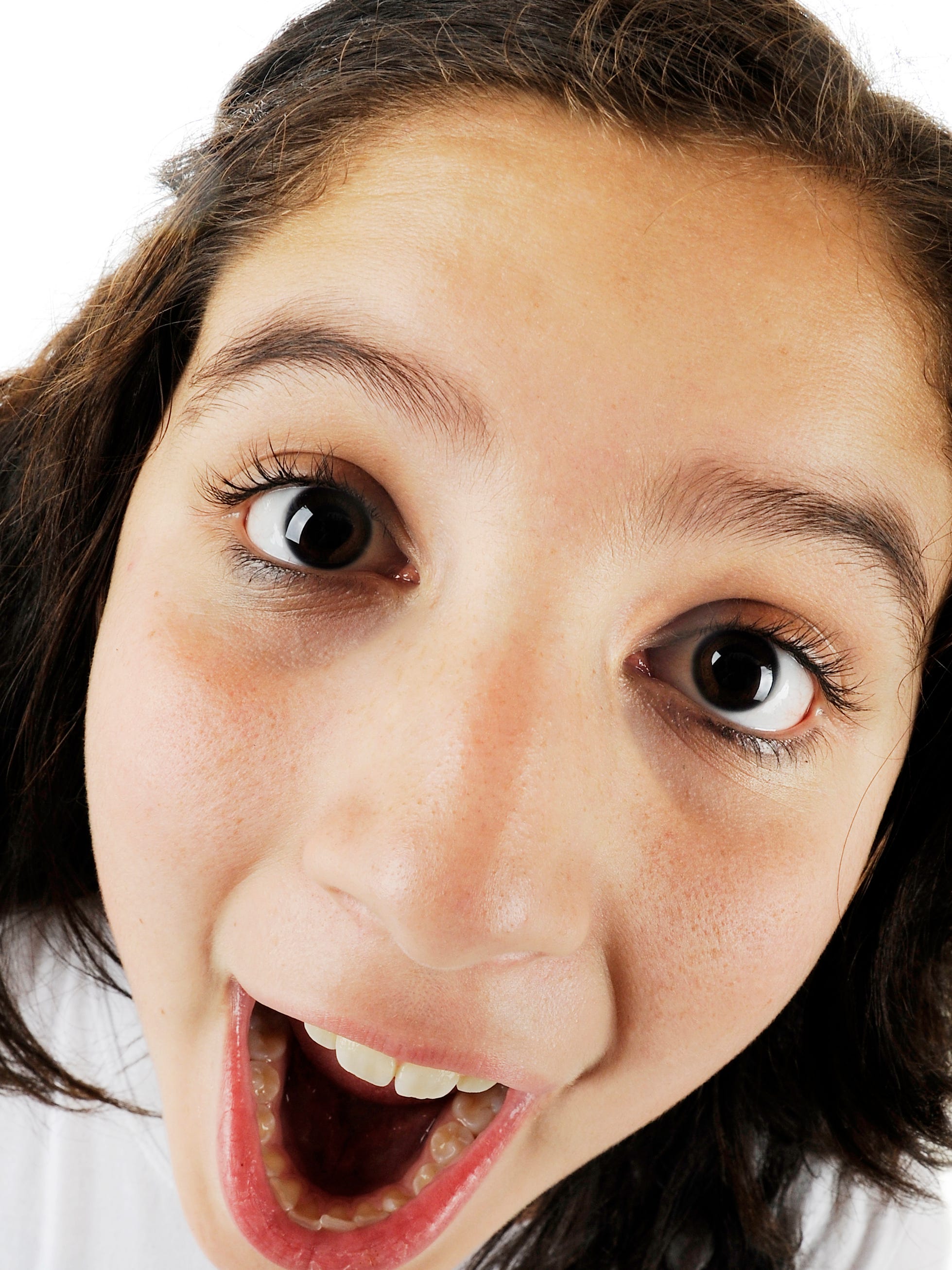 Uncle Suggests Nose Job For 13 Year Old Niece Uncle Suggests Nose Job For 13 Year Old Niece