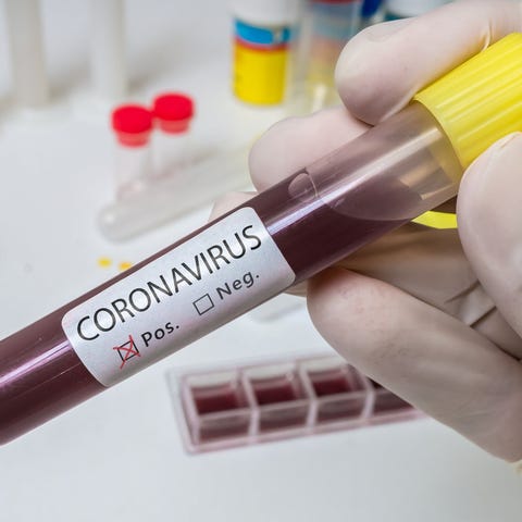 Tube of blood marked positive for coronavirus