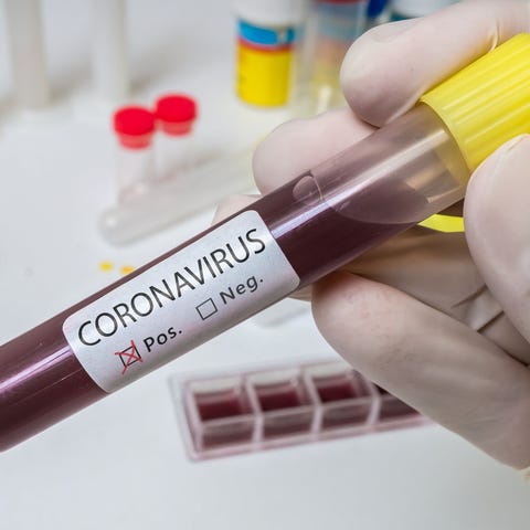 Tube of blood marked positive for coronavirus