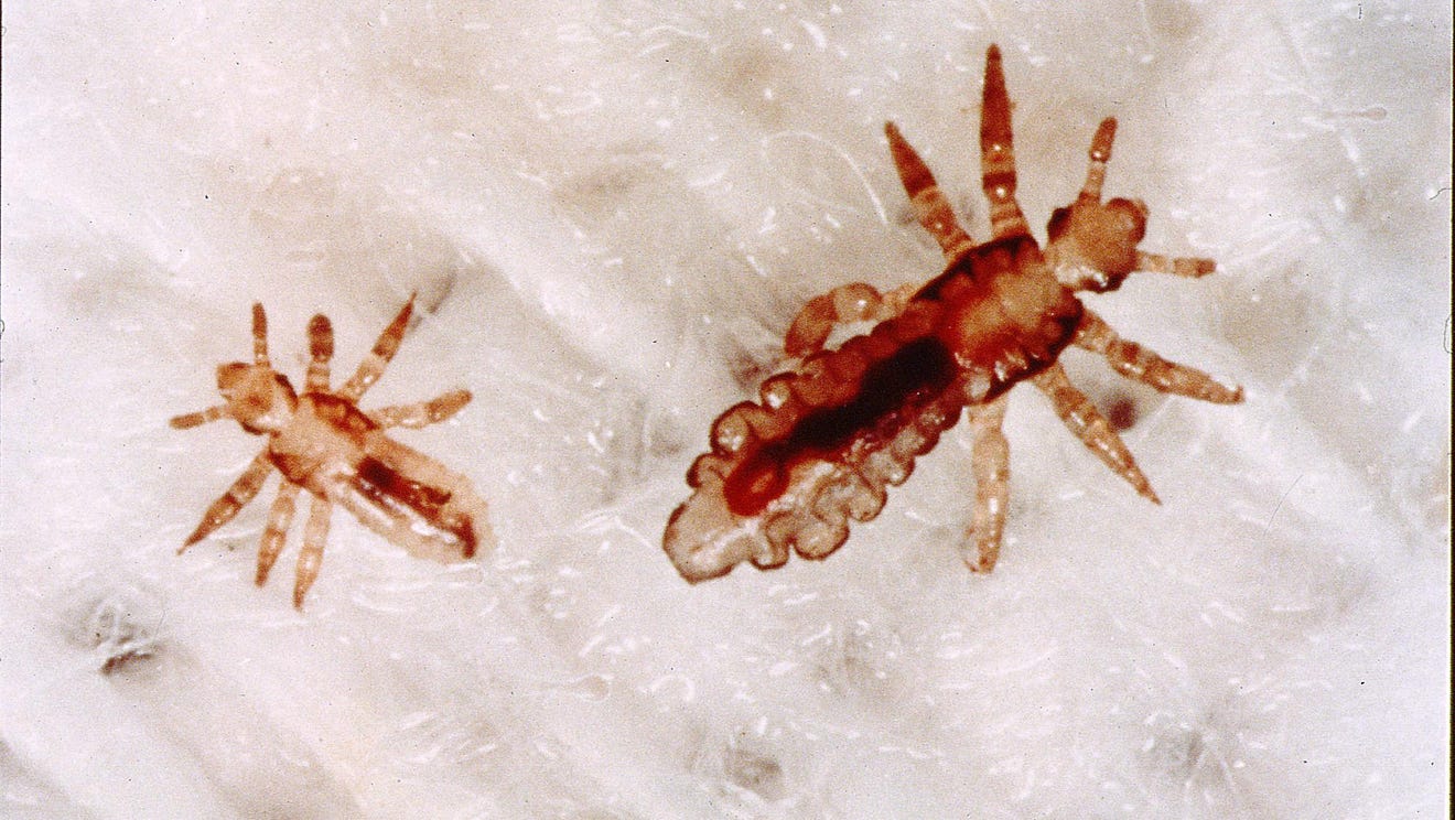 Crabs STD (Pubic lice) detailed Pictures & Images