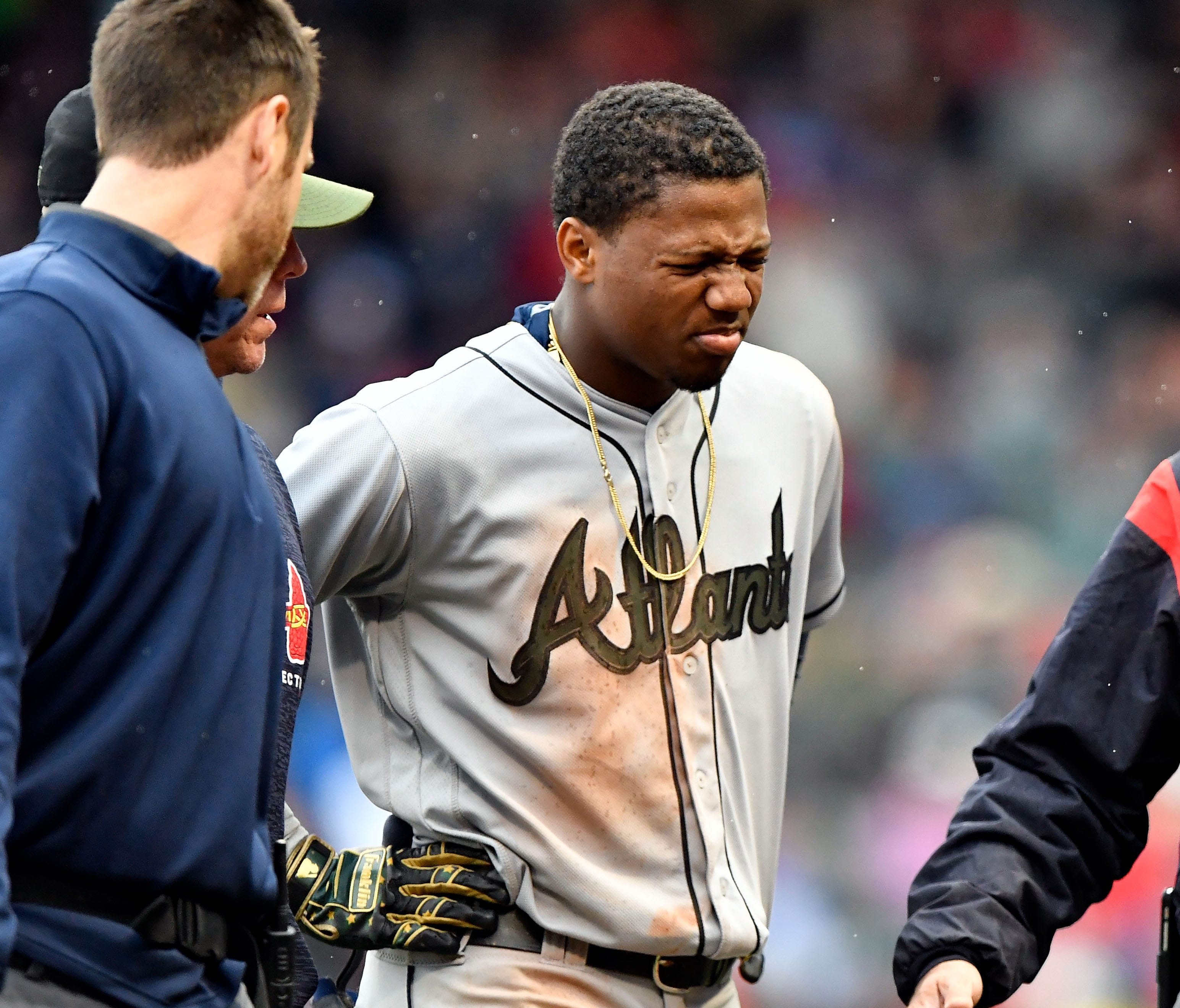 Atlanta Braves outfielder Ronald Acuna Jr. is helped off of the field after injuring his lower leg during the seventh inning Sunday against the Boston Red Sox.