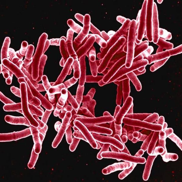 Public Health Oxnard Elementary School Reports Tuberculosis Case