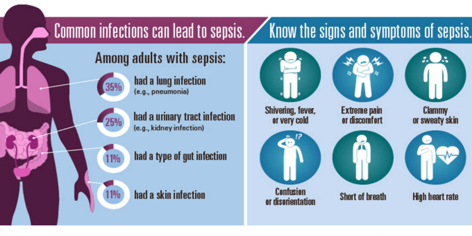 Image result for septic shock