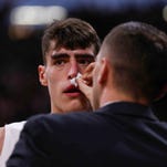 Luka Garza was Iowa basketball's bloody bright spot in dismal showing against Purdue