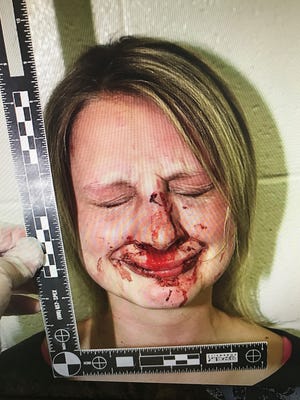 Jillian Beck’s nose and wrist were broken after she was thrown onto gravel by a Las Cruces police officer in January 2013. The officer also slammed her face onto rocks. She and her husband were awarded $1.6 million in damages on Feb. 7, 2017, by a federal jury in Las Cruces.