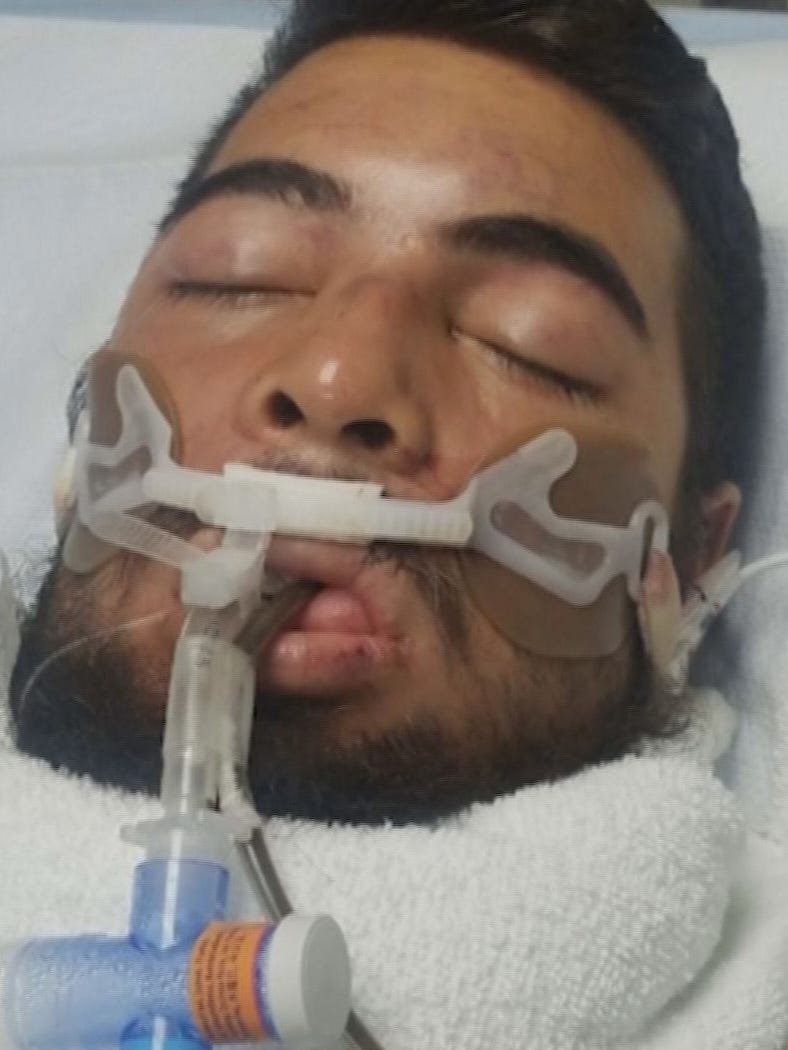 Man Dies After Beating By Sheriff S Deputy S Husband