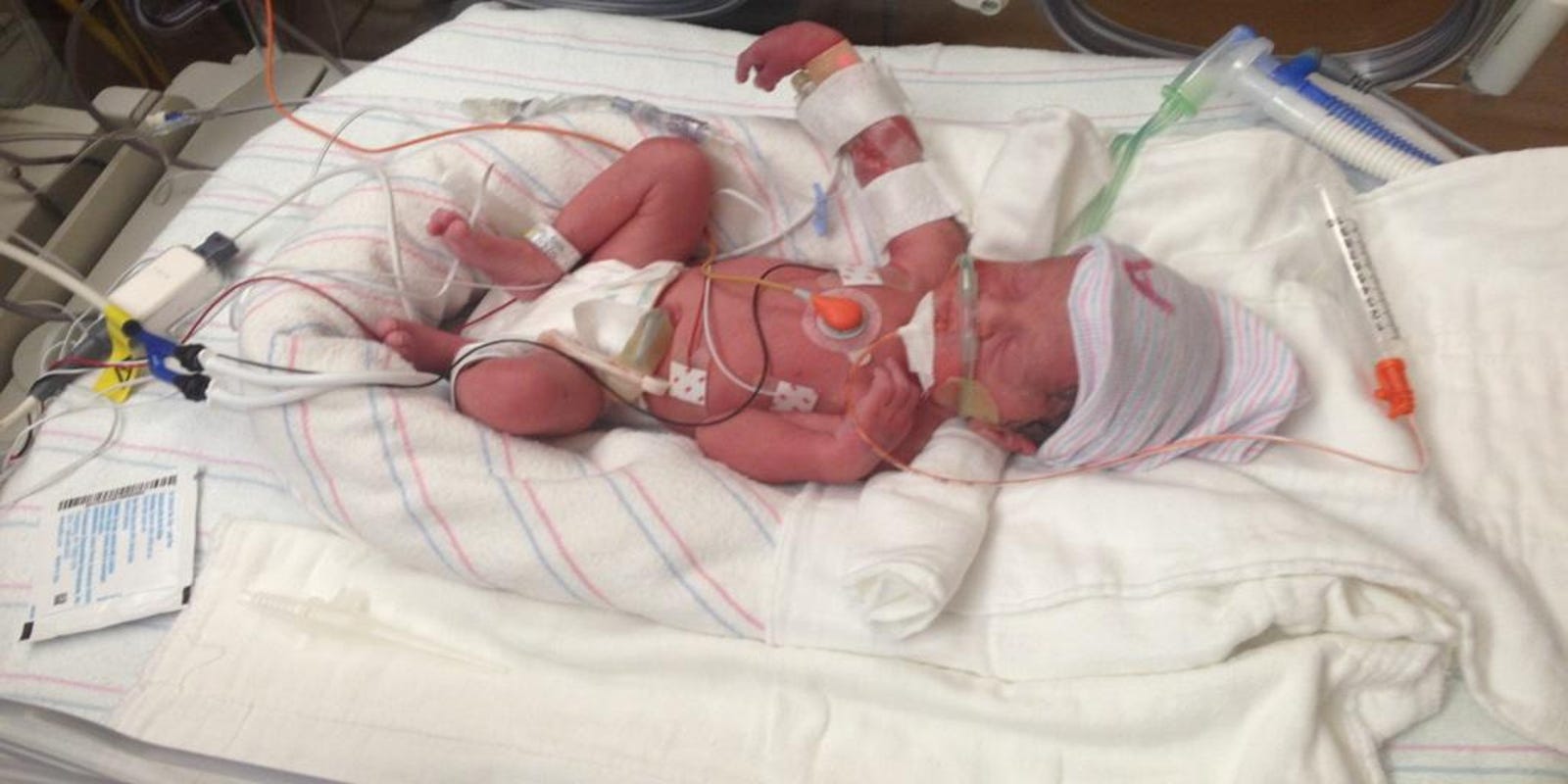 Woman Dies After Birth Of Quadruplets