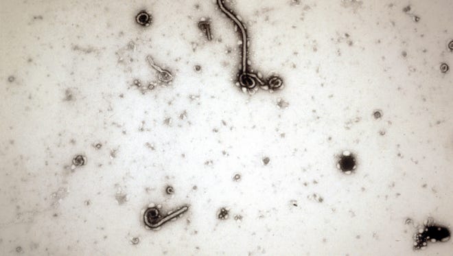 This undated photo made available by the Antwerp Institute of Tropical Medicine in Antwerp, Belgium, show the Ebola virus viewed through an electron microscope. The World Health Organization on Friday, Aug. 8, 2014 declared the Ebola outbreak in West Africa to be an international public health emergency that requires an extraordinary response to stop its spread. (AP Photo/Antwerp Institute of Tropical Medicine)