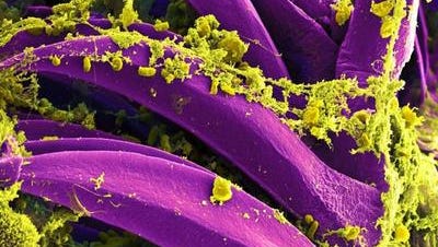 In this digitally colorized image from a scanning electron microscope, Yersinia pestis bacteria, shown in yellow, gathered inside a flea's digestive tract. Yersinia pestis is the bacterium that that causes plague.