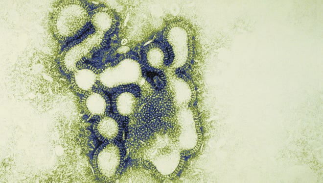 Influenza virus at 295,000 magnification.