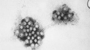 An electron micrograph of the Norovirus, with 27-32nm-sized viral particles.