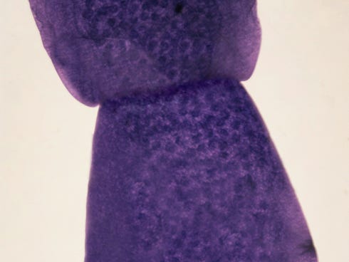 A microscopic image of a portion of a tapeworm.