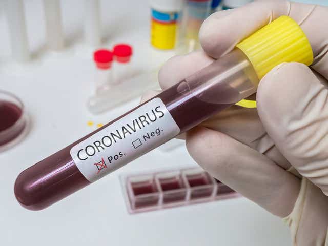 Coronavirus Fuzzy Test Data Hampers Us Public Health Response