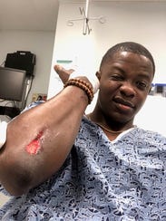 James Shaw Jr. shows injuries he received when he stopped