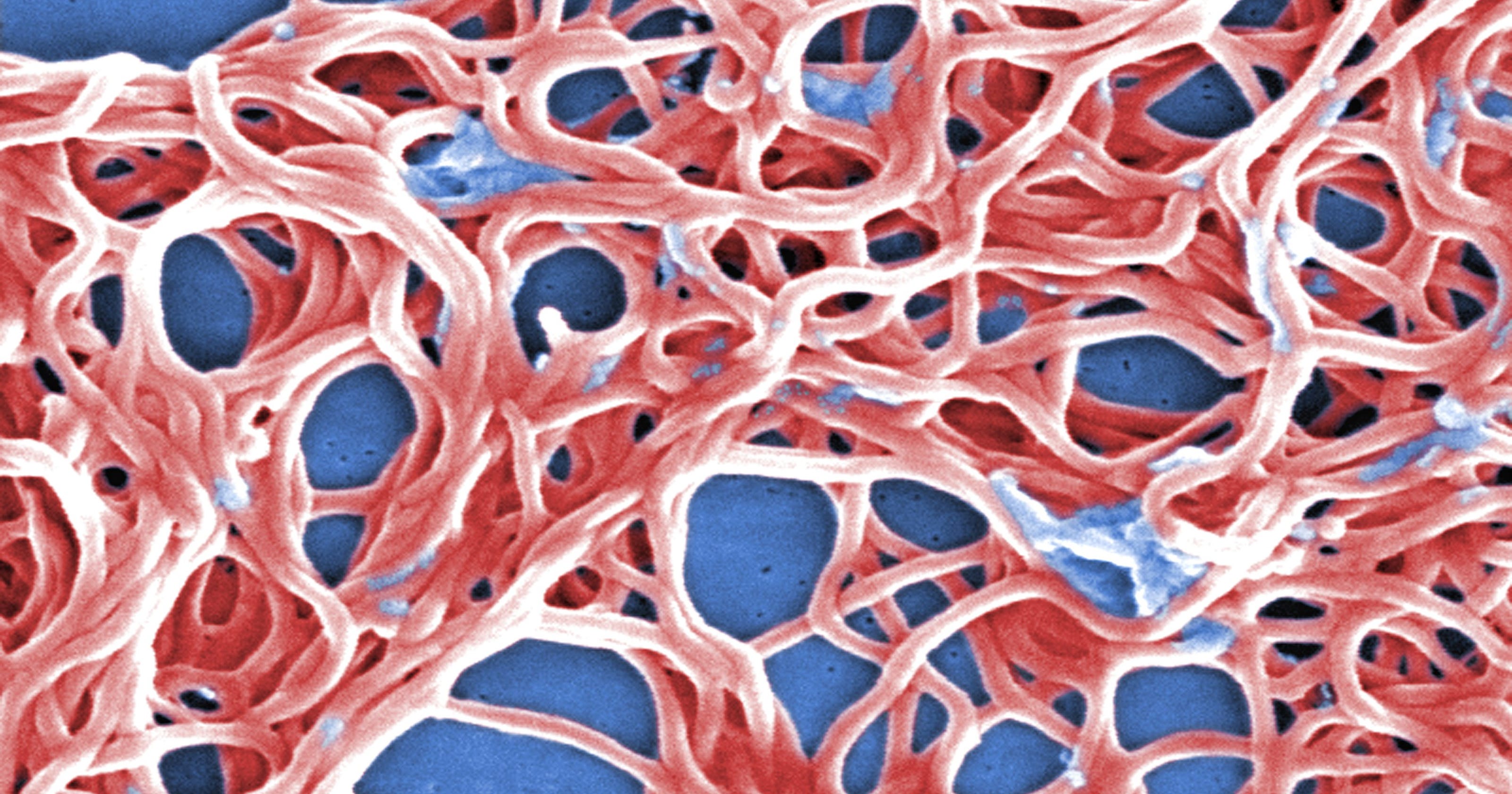 Lyme Are bacteria (or research) being starved to death?