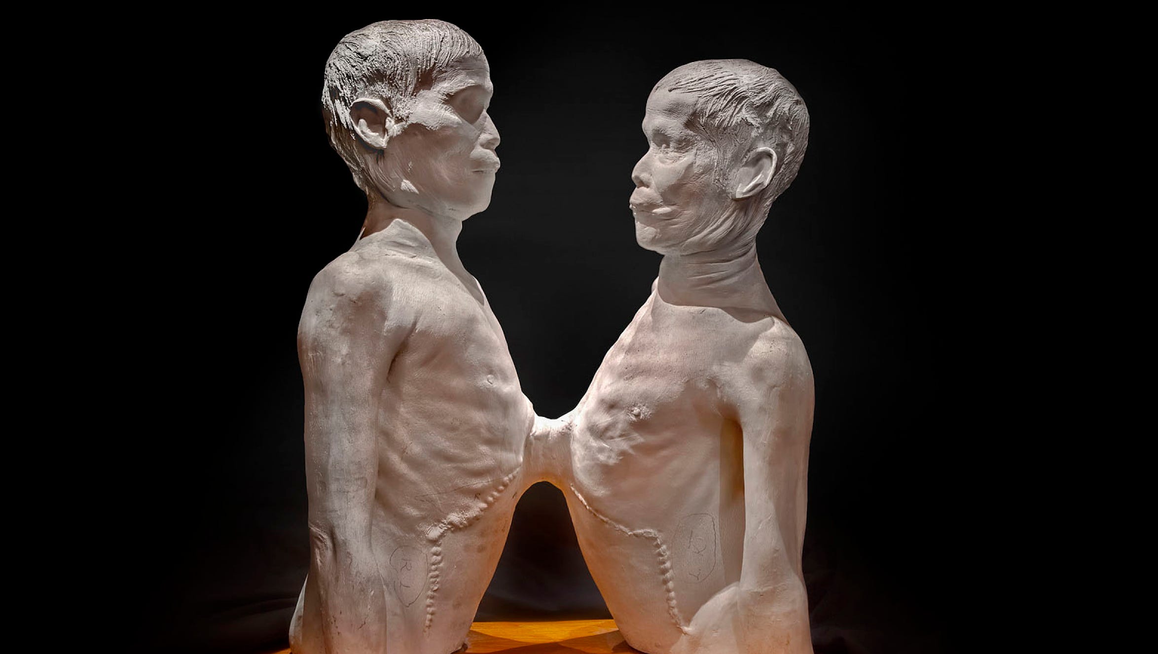Travel: Things get weird at the Mutter Museum