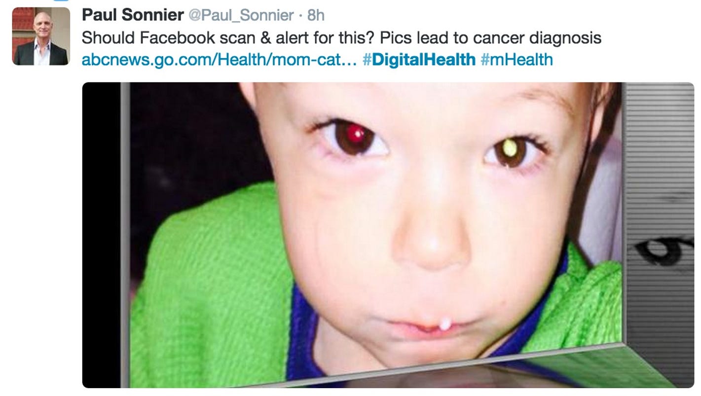 Cellphone photo revealed toddler's eye cancer