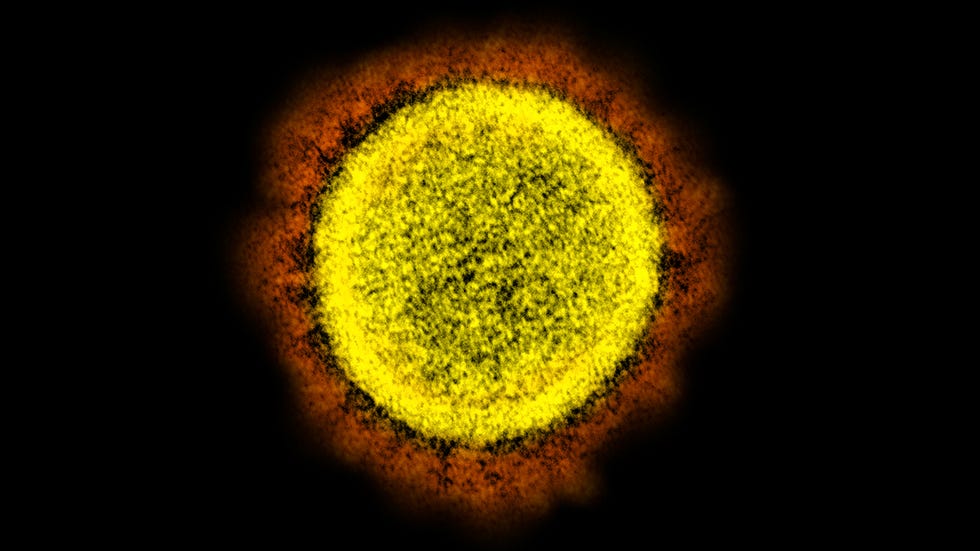 OBRÁZOK - Tento obrázok elektrónového mikroskopu z roku 2020 poskytnutý Národným ústavom pre alergiu a infekčné choroby ukazuje novú časticu koronavírusu SARS-CoV-2 izolovanú od pacienta v laboratóriu vo Fort Detrick, MD.  Pandémiu koronavírusov vnímali mnohí z veľkej desiatky trénerov ako najväčšieho rivala konferenčných tímov prichádzajúcich do tejto vírusom oneskorenej futbalovej sezóny a bol aj.  (cez NIAID / NIH AP, súbor)
