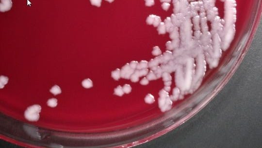 Colonies of anthrax bacteria are seen in a petri dish.