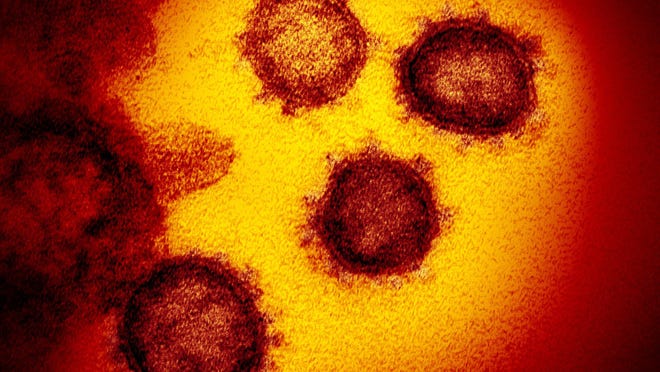 This undated electron microscope image made available by the U.S. National Institutes of Health in February 2020 shows the coronavirus that causes COVID-19. The sample was isolated from a U.S. patient.