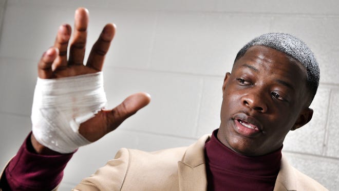 James Shaw Jr., 29, shows his hand that was injured when he disarmed a shooter inside an Antioch Waffle House.  Sunday April 22, 2018, in Nashville, Tenn