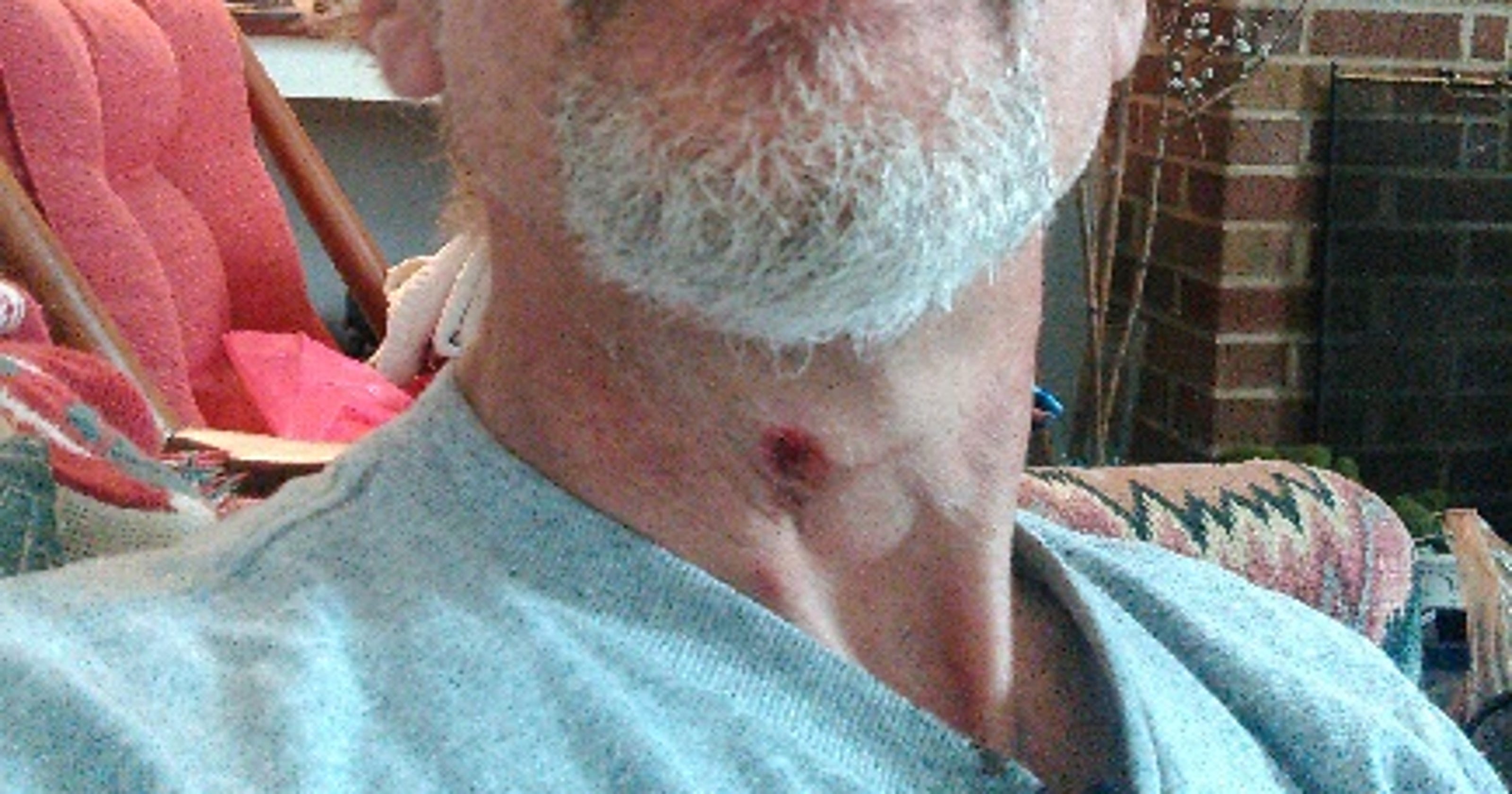 Shooting victim 'The bullet grazed my Adam's apple'