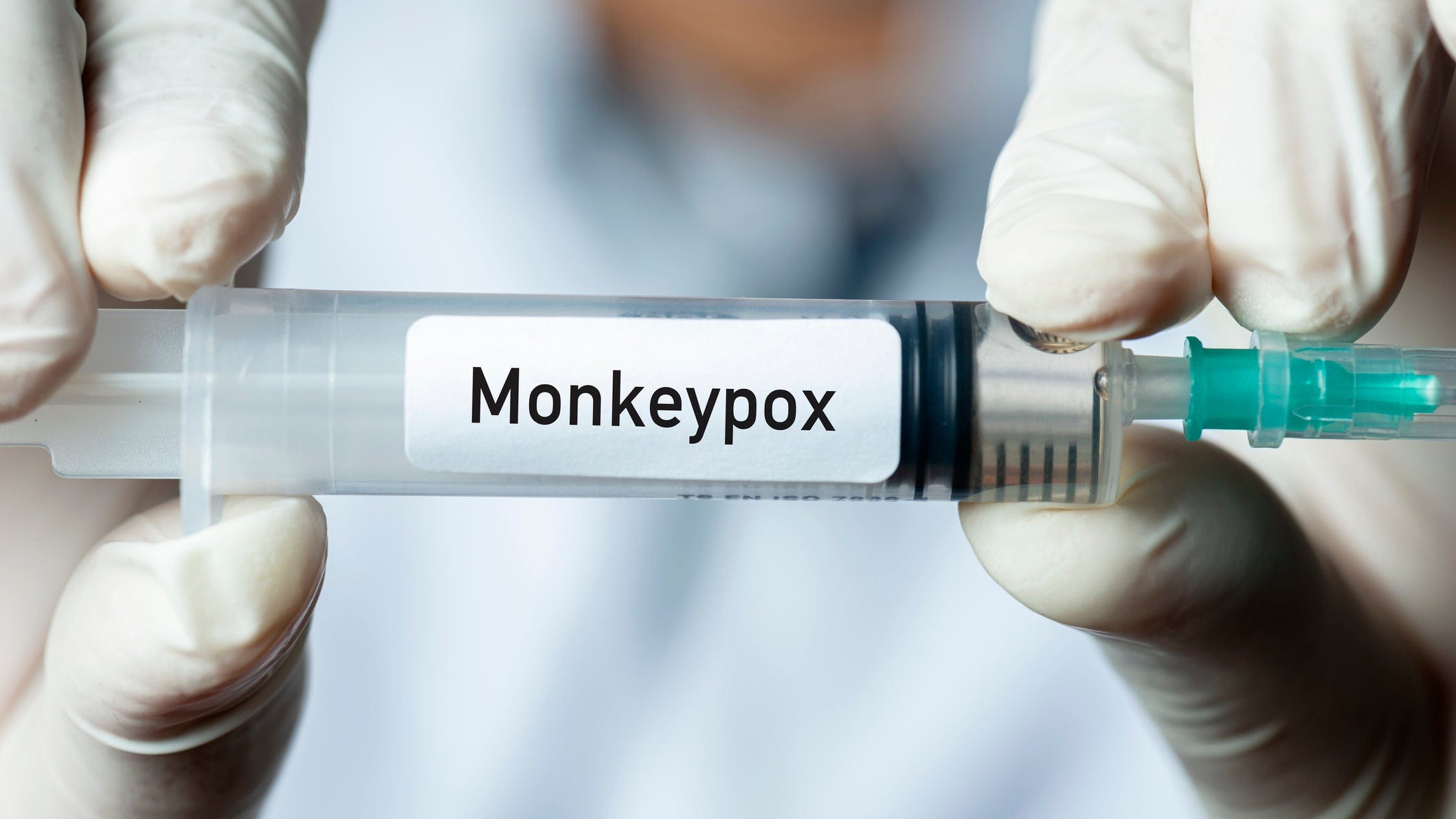 First monkeypox case recorded in Collier County on Friday