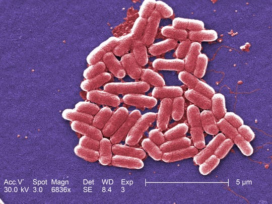 Microscopic picture of an E. coli bacterium. "Width =" 540 "data-mycapture-src =" "data-mycapture-sm-src ="