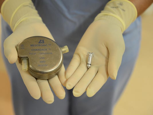 World’s smallest pacemaker available at St. Mary Mercy