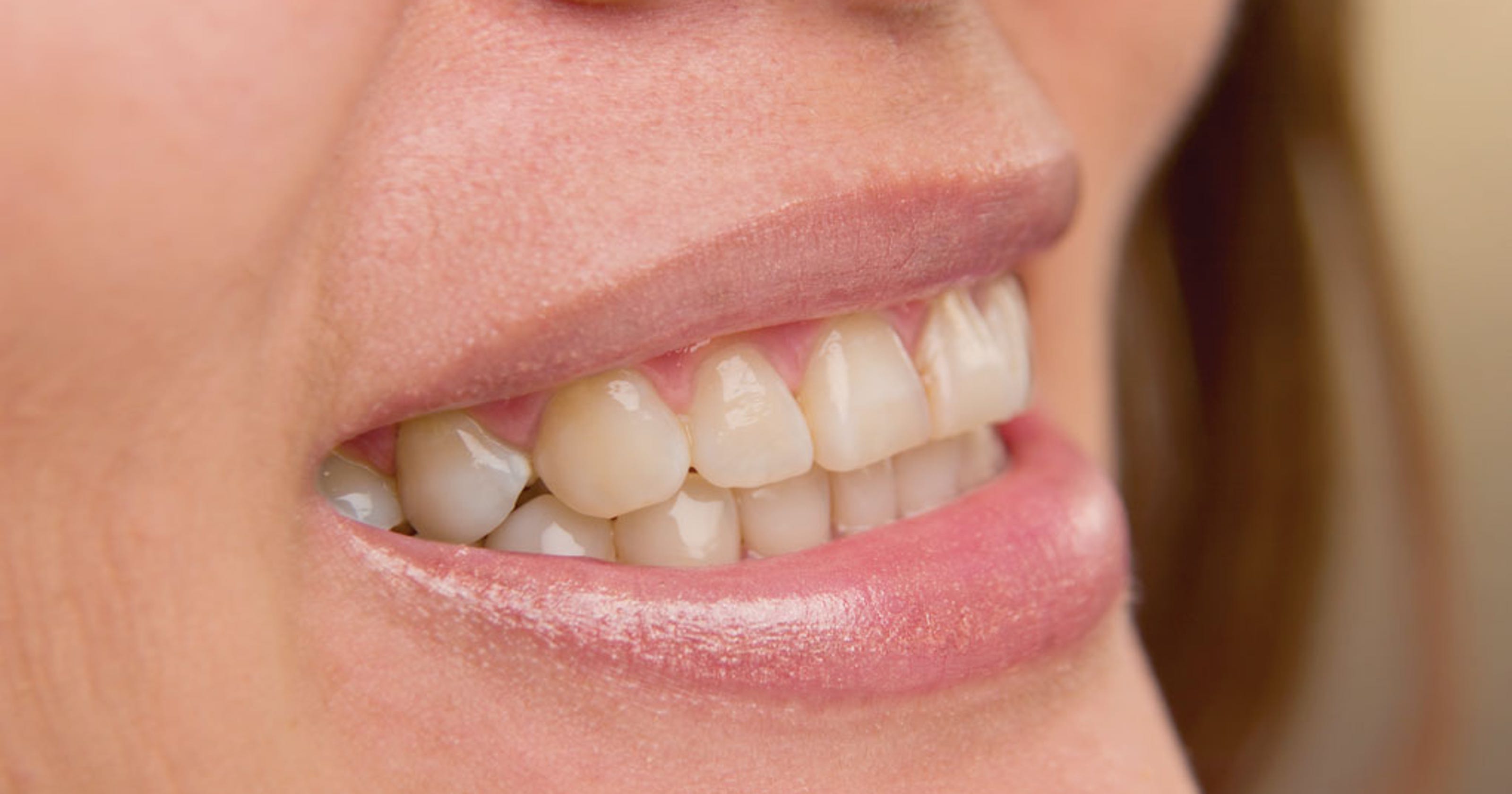 Do bad teeth cause heart disease 