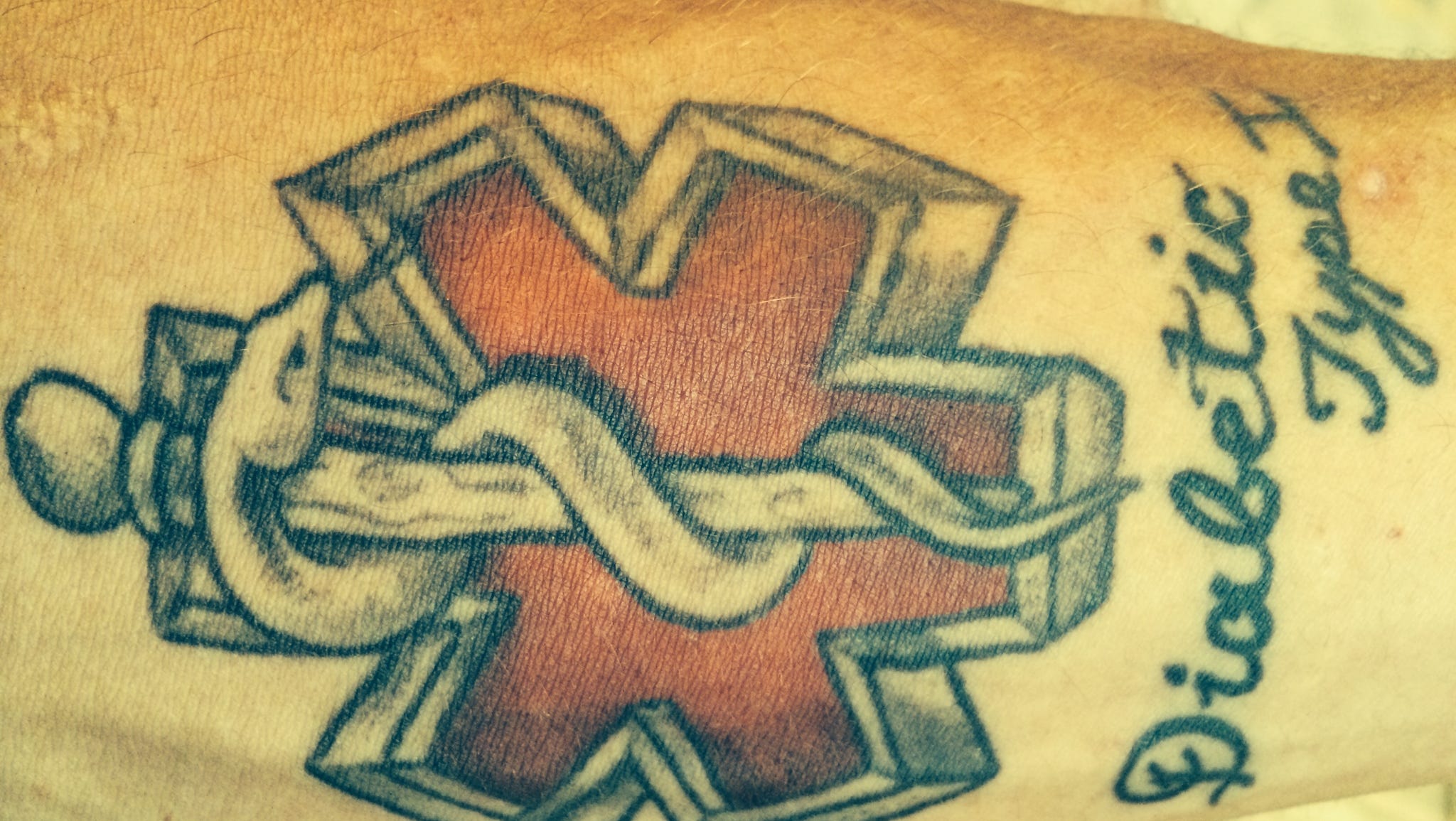 Unregulated rise of medical alert tattoos stirs debate