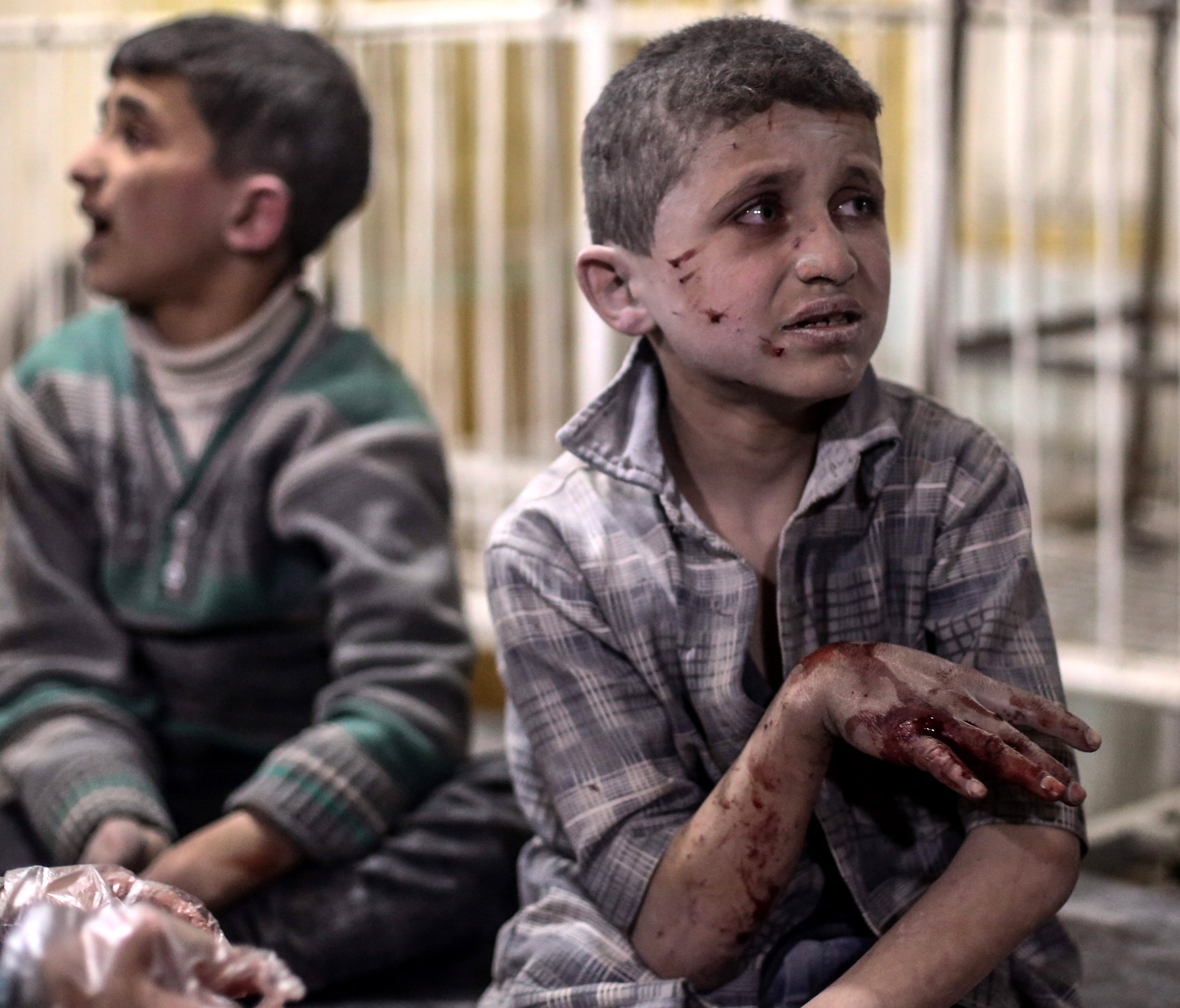 Injured children receive treatment in a field hospital after airstrikes by forces allegedly loyal to the Syrian government, rebel-held Douma, Syria, April 4, 2017.