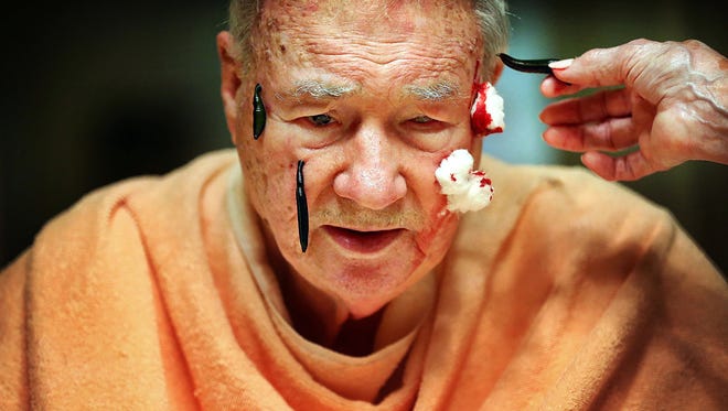 With the help of his wife Marcia, John Dunlap receives his nightly leech treatment at his home in East Memphis. Marcia places several leeches on his face in an effort to increase pressure in his left eye. In conjunction with stem cell treatment, the Dunlaps hope that one day John may be a viable candidate for a procedure that could return some of his vision.