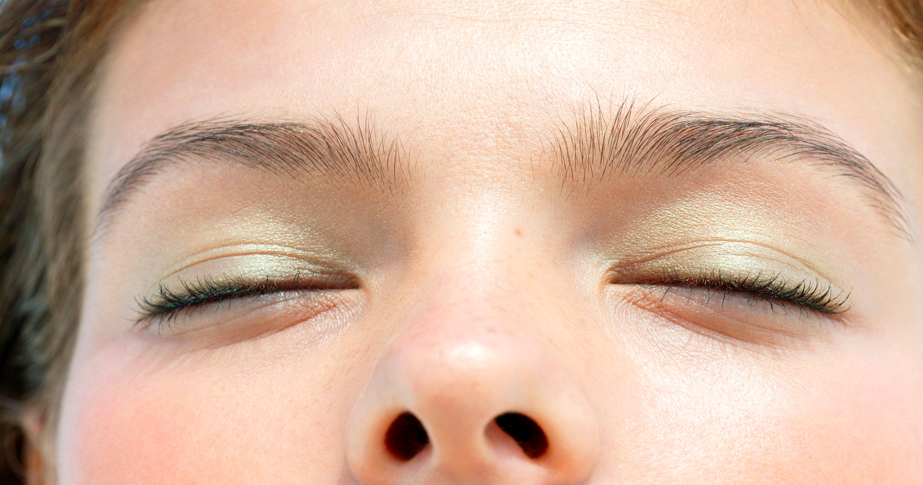What You Can Do About Those Under Eye Circles