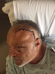 Richard Joseph Hopkins died Aug. 23, 2017, after four