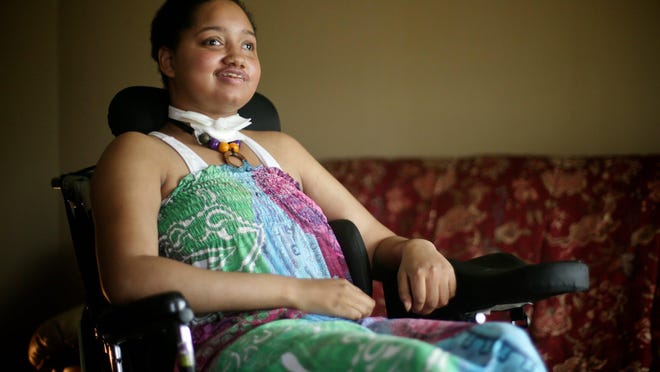 Dreia Davis, 19, of Detroit is photographed in her home on Wednesday, June 17, 2015. Davis in 2009, was shot in the head during a drive-by shooting. Since the shooting, she's had multiple surgeries, was on life support and is now paralyzed on the left side of her body.